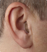 completely in canal hearing aid